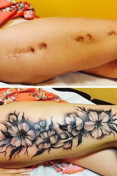 narben-tattoo (10)