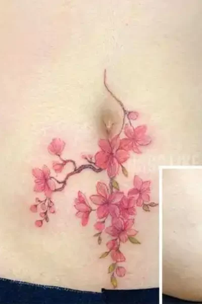 narben-tattoo (4)