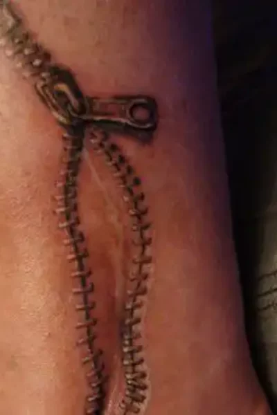 narben-tattoo (7)